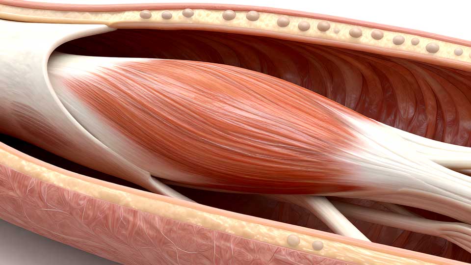 sarcopenia in older adults