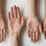 Aged and youthful human hands side by side, illustrating the concept of biological aging as measured by biomarkers